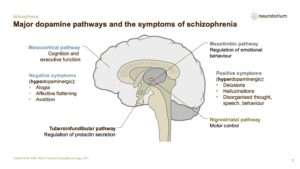 Schizophrenia - Neurobiology and Aetiology - slide 26